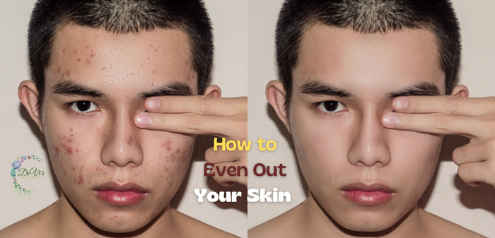 Even Out Your Skin Tone: Simple Step-By-Step Guide – DeVi's Naturals