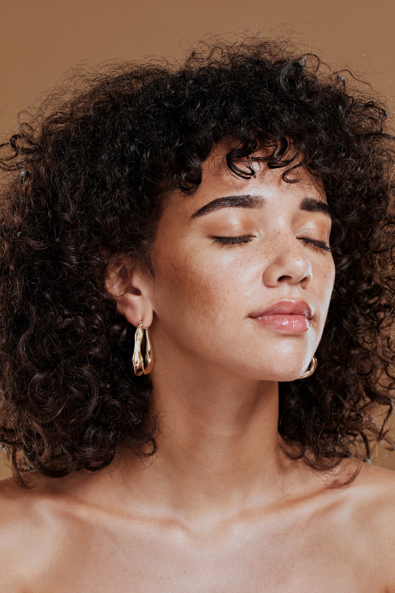 files/Beautiful_Woman_With_Melasma.png